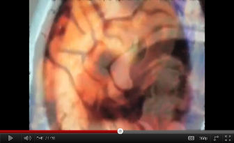 A video on Alien Parasites.